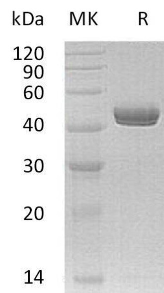 Human Netrin-G1/NTNG1 Recombinant Protein (RPES0182)