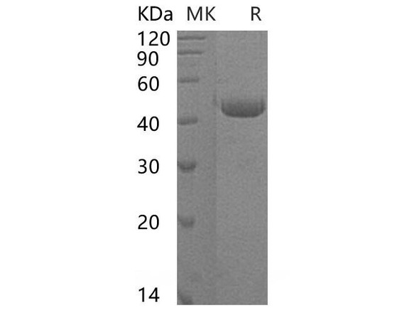 Human ST6GALNAC2 Recombinant Protein (RPES0183)