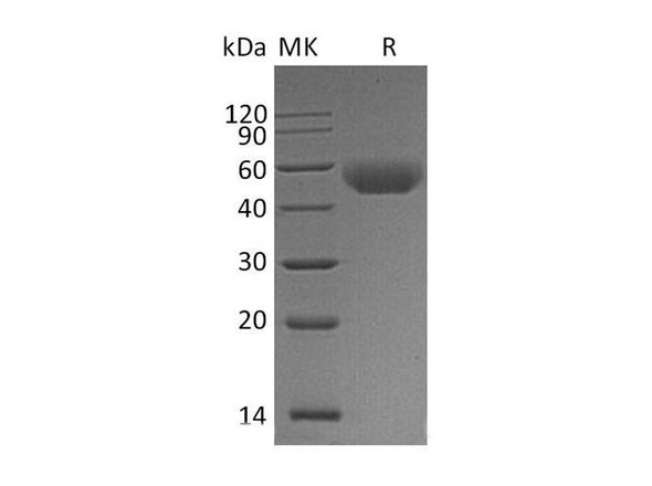 Mouse CD5 Recombinant Protein (RPES0188)