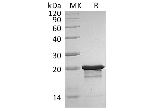Human/Mouse FGF-8b/FGF8B Recombinant Protein  (RPES0191)