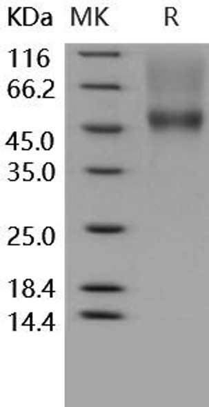 Human CD16a/FCGR3A Recombinant Protein (RPES0192)