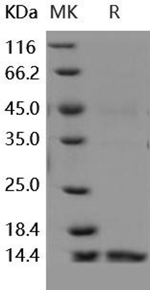 Human Dectin/CLEC7A Recombinant Protein (RPES0195)