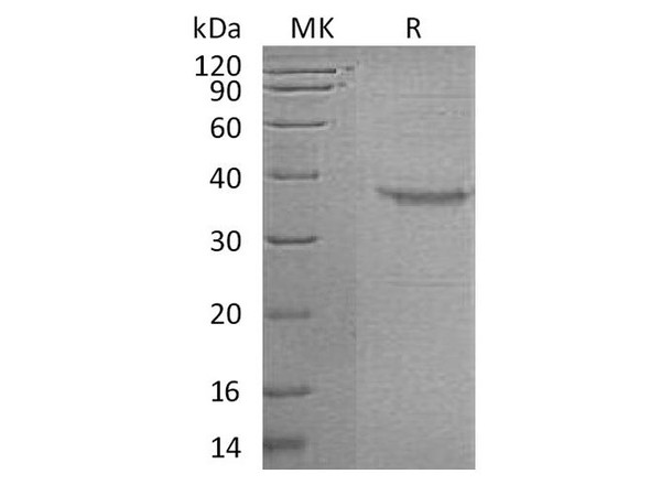 Human Somatoliberin/GHRH Recombinant Protein (RPES0201)