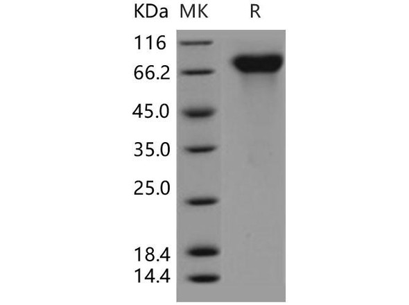 Human PROS1/Protein S Recombinant Protein (RPES0217)