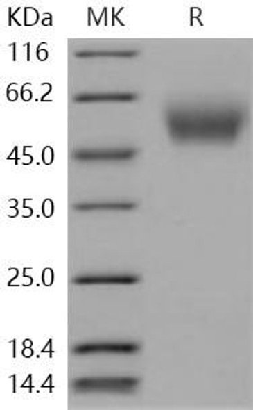 Human CEACAM8/CD66b Recombinant Protein (RPES0231)