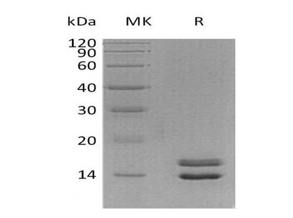 Human NRN1L Recombinant Protein (RPES0240)