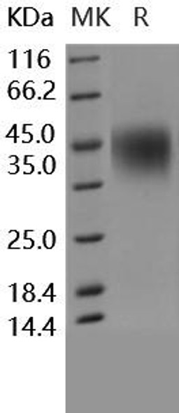 Human CD16a/FCGR3A Recombinant Protein (RPES0248)