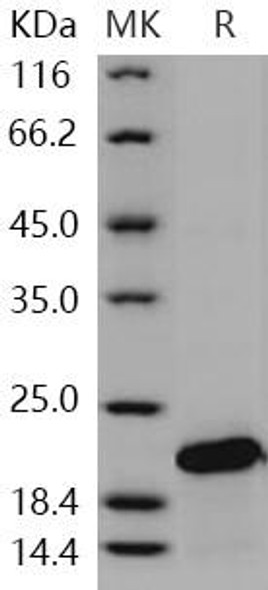 SOD1/Superoxide Dismutase 1 Recombinant Protein (RPES0249)