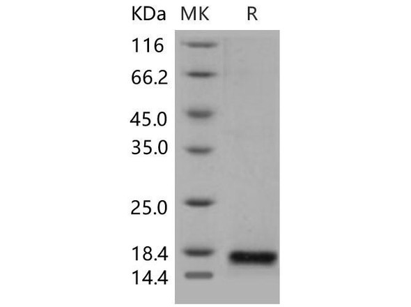 Mouse PLA2G2E Recombinant Protein (RPES0253)