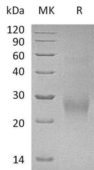 Human CDK2AP2 Recombinant Protein (RPES0257)