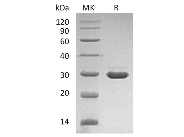 Human Beta-NGF/NGFB Recombinant Protein (RPES0265)