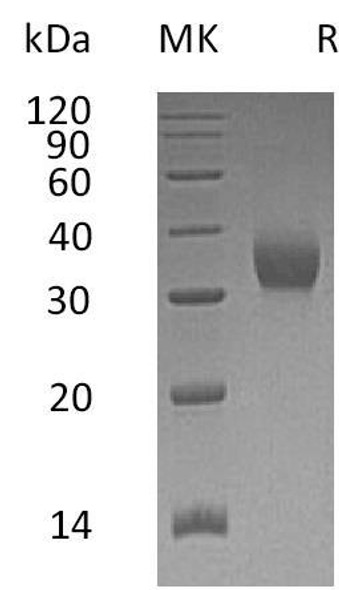 Human CEACAM21 Recombinant Protein (RPES0277)