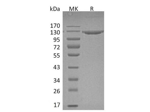 Mouse VCAM1 Recombinant Protein (RPES0286)