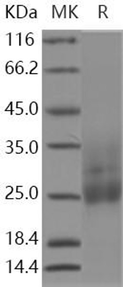 Human Mucin/MUC Recombinant Protein (RPES0294)