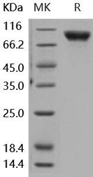 Human CD146/MCAM Recombinant Protein (RPES0295)