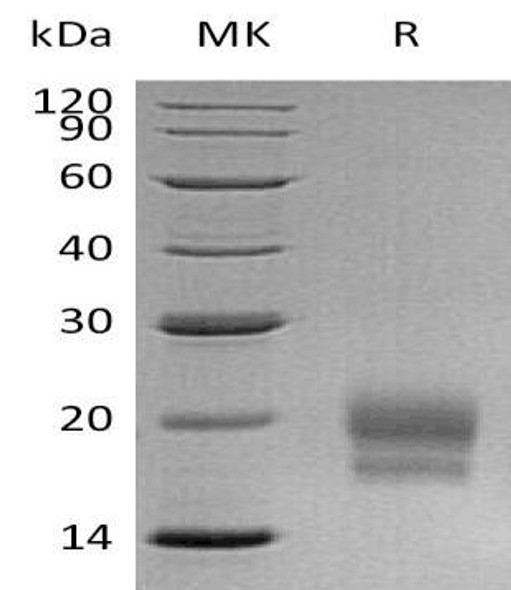 Human CEACAM3/CD66d Recombinant Protein (RPES0296)