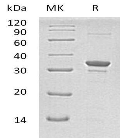 Human SULT1A2 Recombinant Protein (RPES0299)