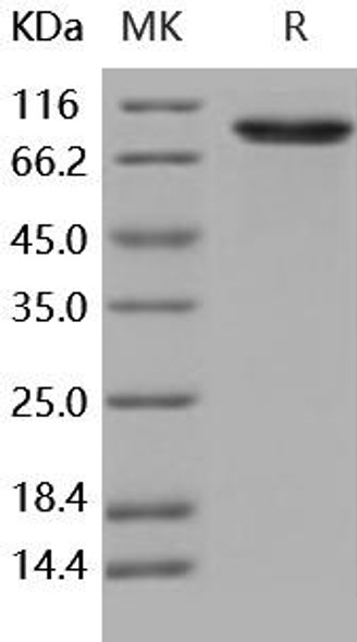 Human DDR2 Kinase/CD167b Recombinant Protein (RPES0310)