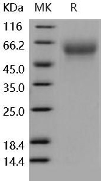 Human CD155/PVR Recombinant Protein (RPES0335)