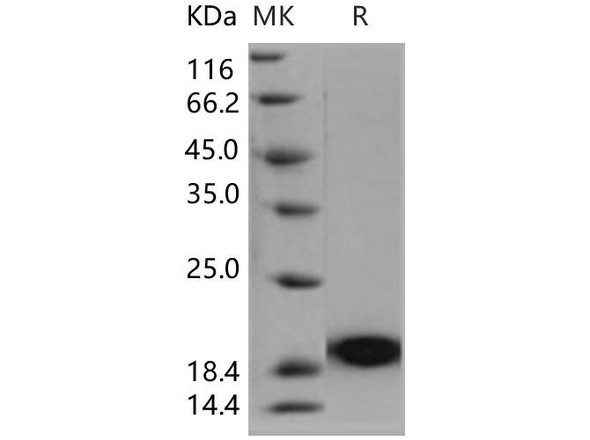 Human PLA2G1B/PLA2 Recombinant Protein (RPES0349)