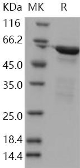 Human NFkB p65 Recombinant Protein (RPES0354)