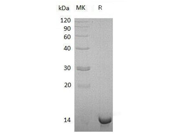 Sulfotransferase/SULT1C4 Recombinant Protein (RPES0359)