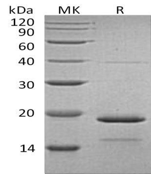 Human HSPB7 Recombinant Protein (RPES0374)