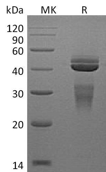 Rat Interleukin2/IL2 Recombinant Protein (RPES0377)