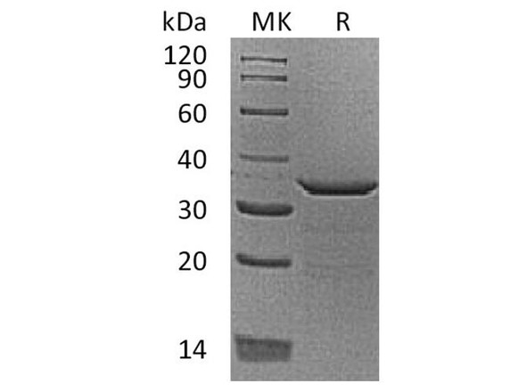 Human Proenkephalin-B/PDYN Recombinant Protein (RPES0381)