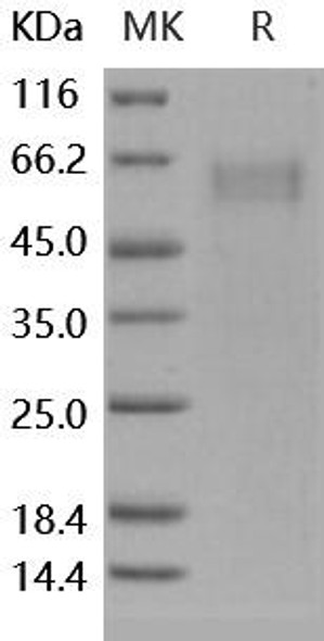 Human IL1RL1/ST2 Recombinant Protein (RPES0392)