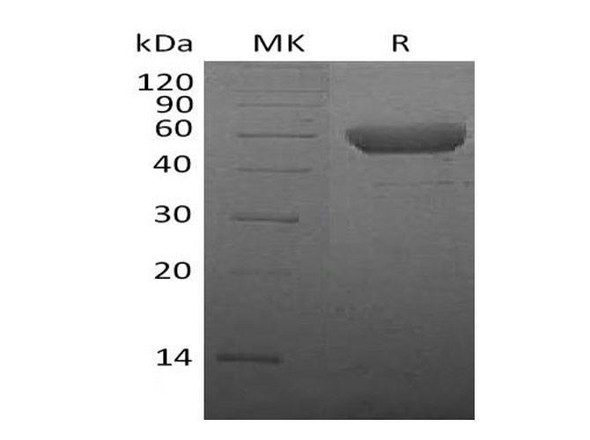 Mouse CTLA4 Recombinant Protein (RPES0398)