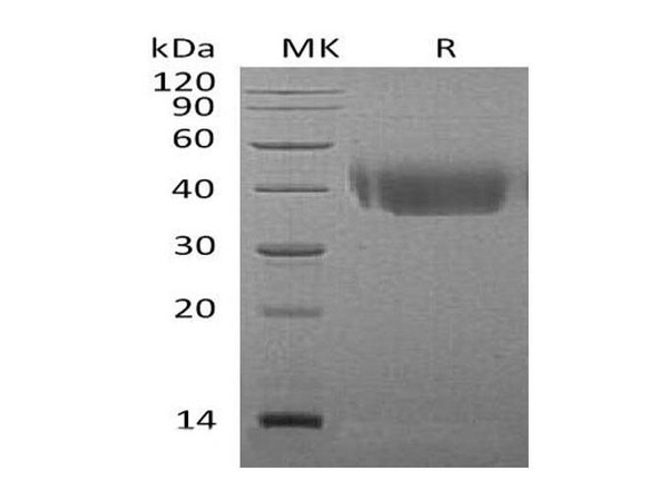 Mouse CD226/DNAM Recombinant Protein (RPES0400)
