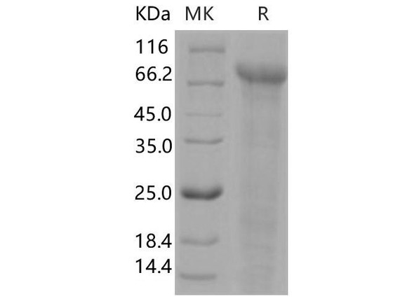 Human Jagged 1/JAG1 Recombinant Protein (RPES0405)