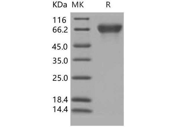 Human Nectin-3/PVRL3 Recombinant Protein (RPES0406)