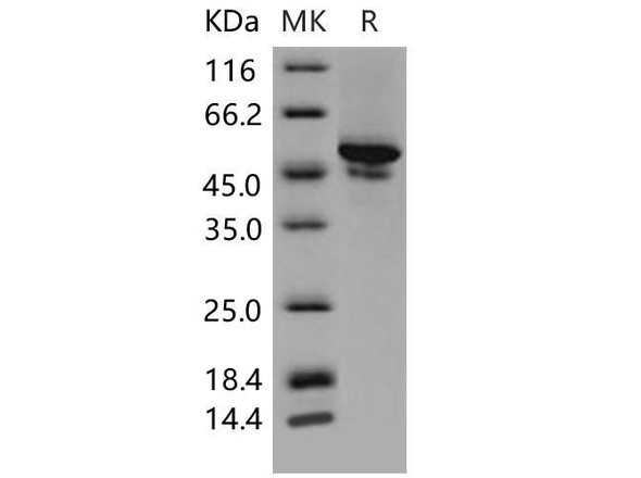 Mouse CA9 Recombinant Protein (RPES0409)