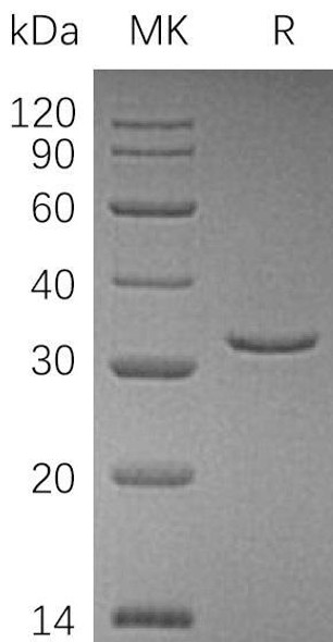 Human RIDA/HRSP12 Recombinant Protein (RPES0414)