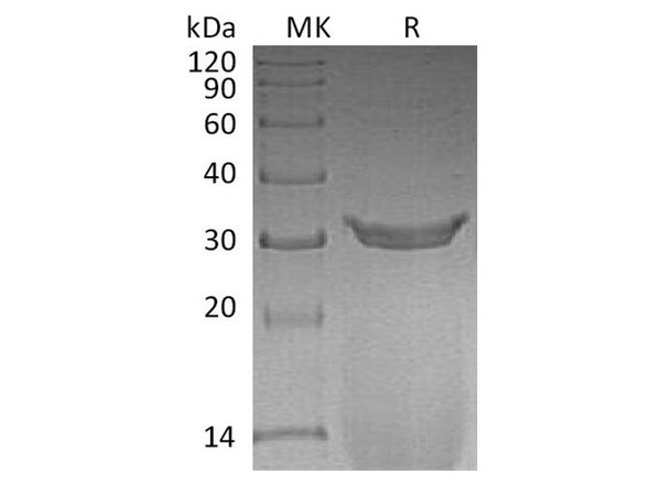 Rat IgG2A Fc/Igg-2a Recombinant Protein (RPES0417)