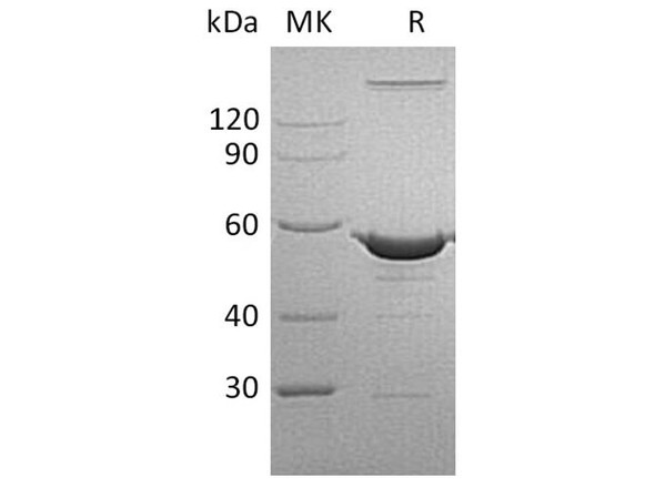 Human PBEF/NAMPT Recombinant Protein (RPES0421)