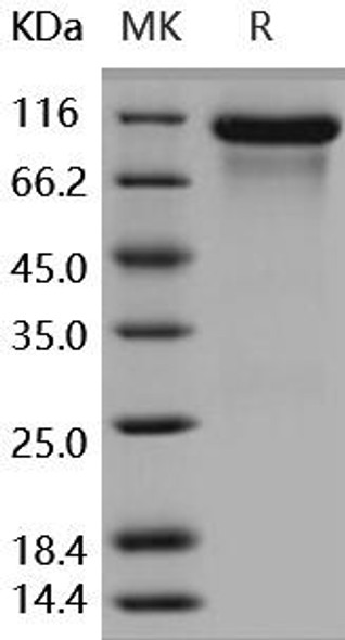 Human HER3/ErbB3 Recombinant Protein (RPES0427)