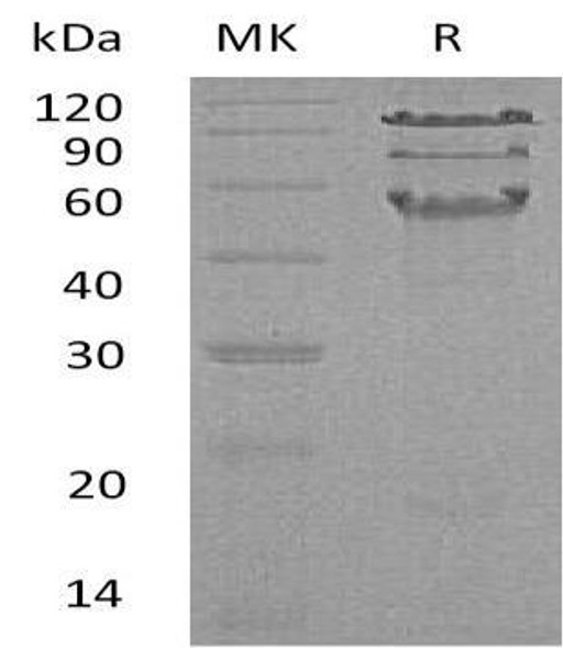 Human HCLS1 Recombinant Protein (RPES0434)