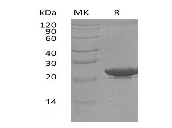 Human NGAL/Lipocalin-2 Recombinant Protein (RPES0435)