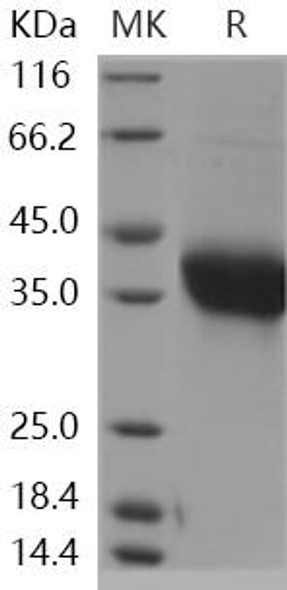 Human ADM/Adrenomedullin Recombinant Protein (RPES0444)