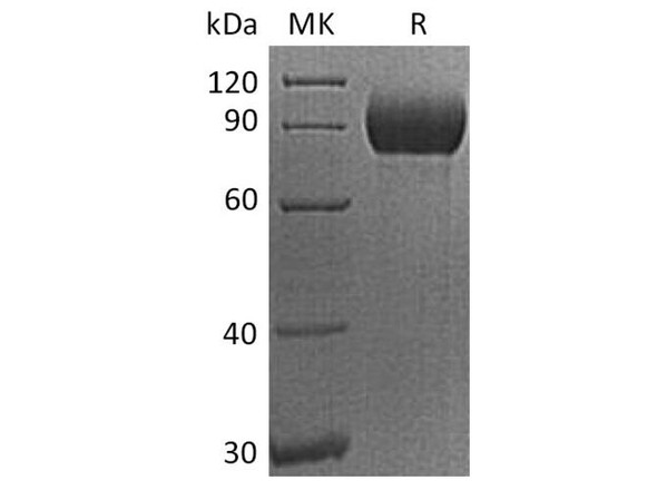 Human CD155/PVR/NECL5 Recombinant Protein (RPES0460)