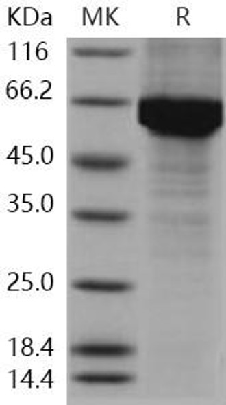 Human HSP70/HSPA1A Recombinant Protein (RPES0462)