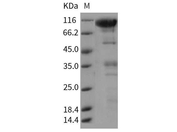 Rat CLEC14A/EGFR-5 Recombinant Protein (RPES0466)