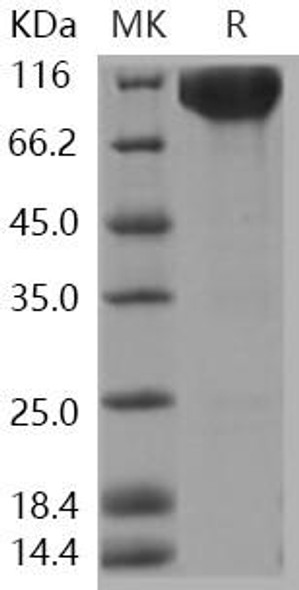 Human c-KIT/CD117 Recombinant Protein (RPES0468)