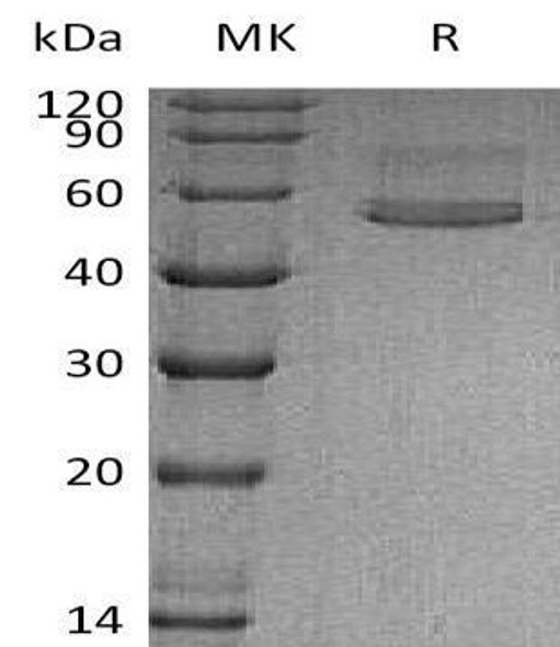 Human Chitotriosidase/CHIT1 Recombinant Protein (RPES0470)