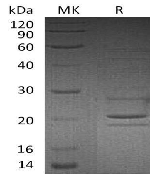 Human Syntaxin-8/STX8 Recombinant Protein (RPES0473)