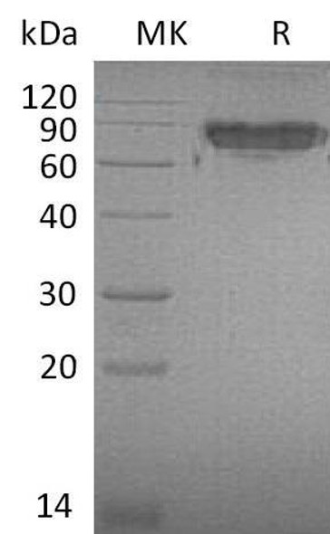 Mouse ICAM-2/CD102 Recombinant Protein  (RPES0486)