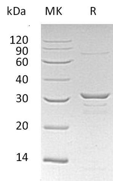 Human CLIC1 Recombinant Protein (RPES0490)